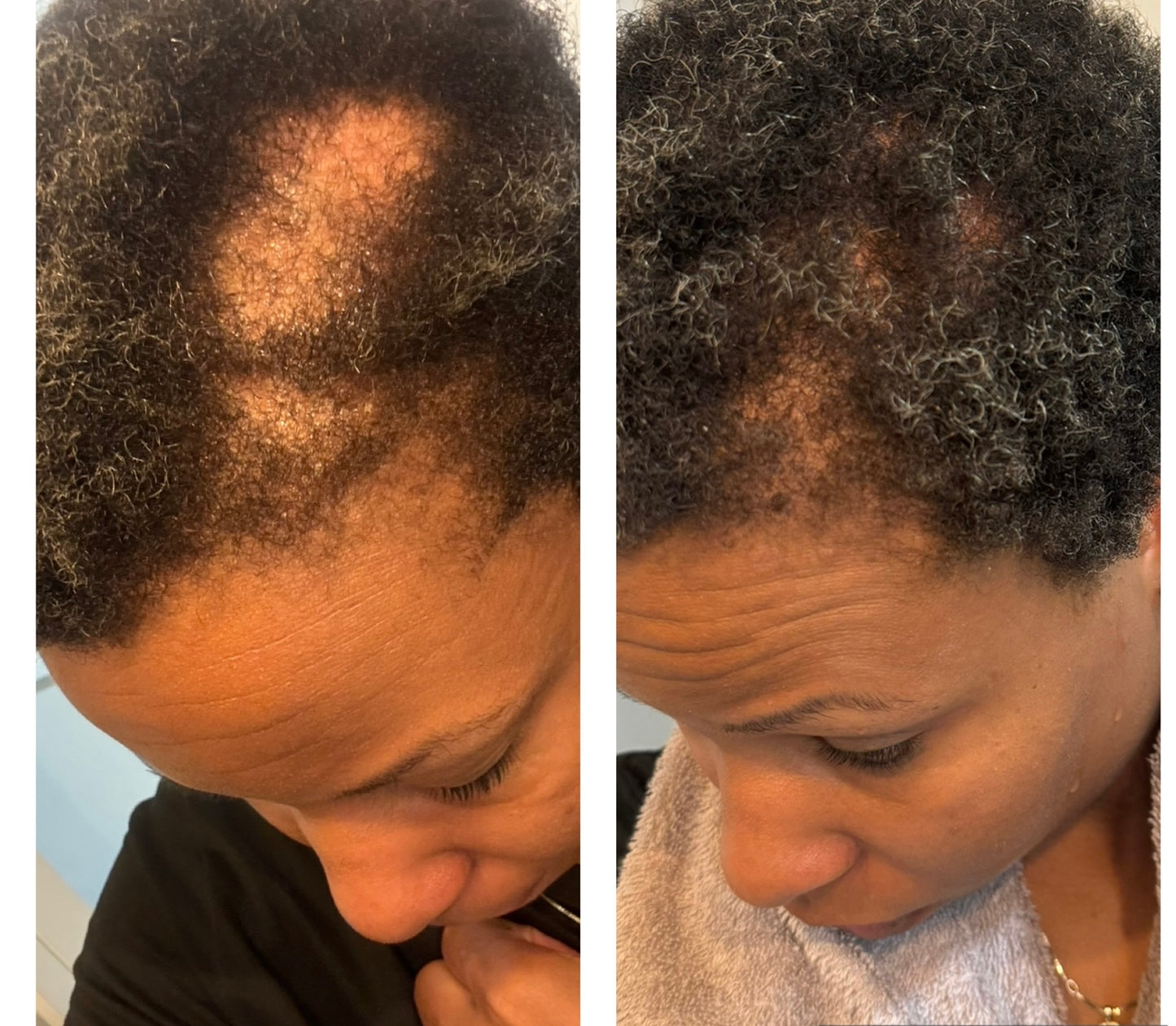 Herbal Hair Growth Oil